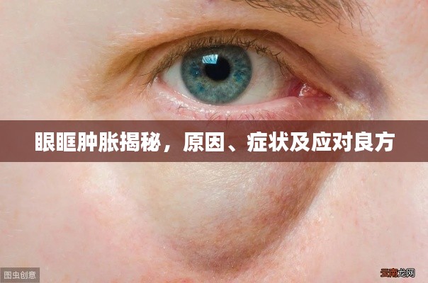 眼眶腫脹揭秘，原因、癥狀及應(yīng)對(duì)良方